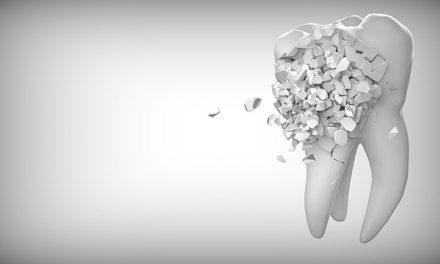 De voordelen van biologische tandheelkunde