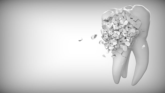 De voordelen van biologische tandheelkunde